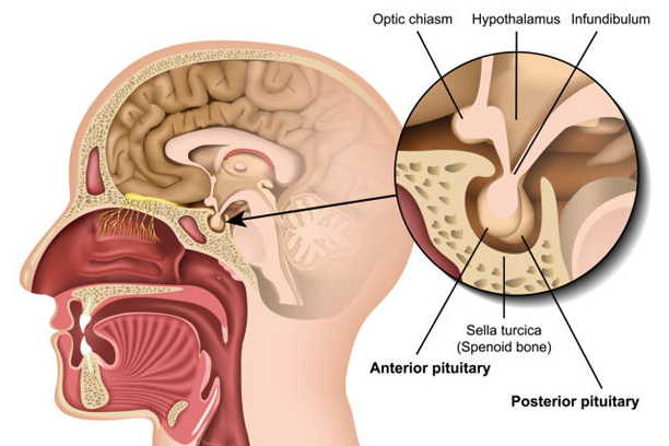 Pituitary and Parathyroid Disorders
